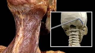 4 1 13 Músculos posteriores del cuello