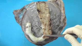 Fixed Placenta Membrane Dissection Tutorial - for medical professionals