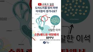 유튜브 QnA: 도리도리를 많이 하면 이석증이 생길 수도 있나요? #shorts