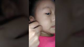 my 2y.o dry earwax removal