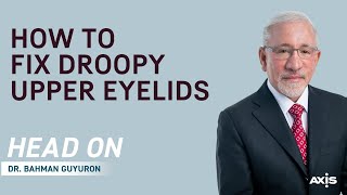 How To Fix Droopy Upper Eyelids