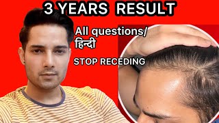 My RESULT| HAIR Question/Answer| How to Regrow Hair|minoxidil|TRANSPLANT|LOSS||Finasteride|Hindi