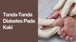 Tanda-Tanda Diabetes Pada Kaki