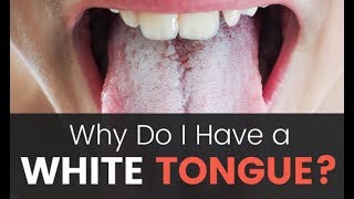 How to Remove White Patches on Your Tongue Naturally At Home