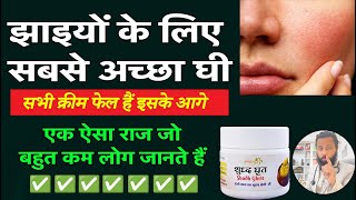 Best Desi Ghee For Pigmentation ✅  -  Dr Prateek chauhan