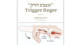 "אצבע הדק" | Trigger finger