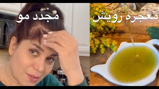 معجزه رویش مجدد مو با مواد ۱۰۰٪ طبیعی ! How to grow your bald spot for real