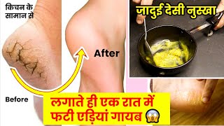 ये देसी नुस्खा लगाते ही फटी एड़ियो से हमेशा के लिए छुटकारा मिल जायेगा cracked heels home remedies