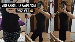 MİDE BALONUM ÇIKTI / Hastane ve Narkozdan Ayılma Sürecim / Açlık Hissediyor muyum?