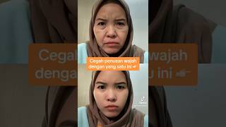 #antiaging #antiagingtreatment #antiwrinkletreatment #flekhitamhilang #melasmatreatment #treatments