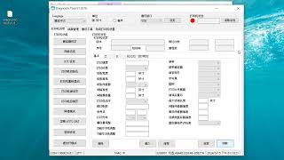 How to adjust IP in the internet port (label printer )