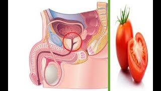 Natural Ways to Improve Prostate Health