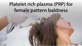 Platelet rich plasma (PRP) for female pattern baldness