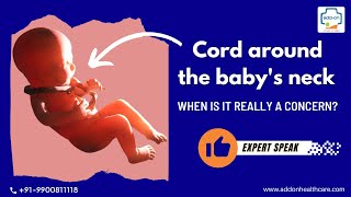 What is Cord around the baby's neck? | add-on Scans & Labs | Dr. Sunil Kumar G S