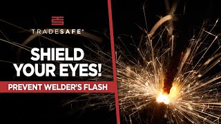 Welder’s Flash: Remedies & Prevention