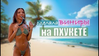 Сделала виниры на Пхукете🤑 РАЗВОД на МИЛЛИОН в Москве #виниры #винирымосква