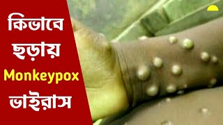 Monkeypox ভাইরাস কি ? What is Monkeypox Virus ? রোগের লক্ষণ এবং চিকিৎসা || Symptoms and treatment ||