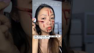 Chemical Peel🥰 #shorts #viral #trending #makeup #fypシ #fyp #trending #fypシ #shortvideo #ytshorts