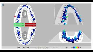 T-Scan Novus Introduction