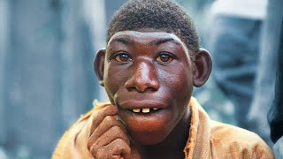 Rare Humans You Didn't Know About