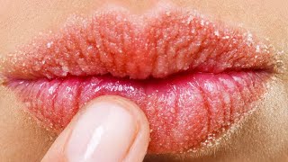 وداعا للشفاه الجافة وصفات طبيعية 👄 👄 #شفاه جافة