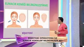 Bişektomi operasyonuyla kare yüzden üçgen yüze geçiş olur mu, estetik olarak güzel görünür mü?