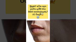 මුහුණේ අධික දහඩිය වළක්වාගනිමු😲✨ #shorts #health #sinhala #viral