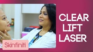 Clear Lift Laser || Diwali Special || Skinfiniti