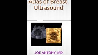 A collection of my (Dr Joe Antony, MD) ebooks and  print books available on Amazon Kindle and store