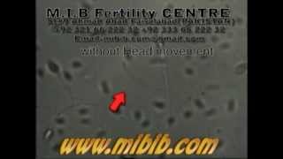 movement of live sperm without head,without head sperm video