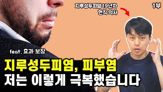 1부ㅣ지긋지긋한 지루성피부염, 꼭 이렇게 치료하셔야 합니다! (feat. 지루성두피염, 모낭염, 탈모)