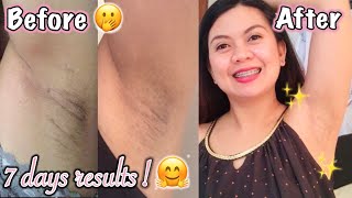 PAANO PUMUTI ANG KILIKILI? | Mabisang paraan *NATURAL REMEDY | EFFECTIVE ROUTINE TO WHITEN UNDERARMS