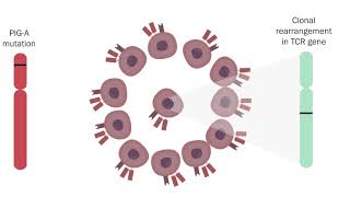 Uncovering the cause of paroxysmal nocturnal hemoglobinuria (Ann Lab Med)