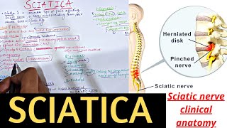 SCIATICA | Sciatic nerve clinical Anatomy | clinical Anatomy series 8