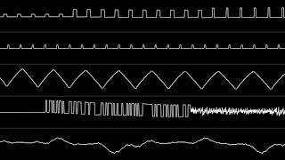 marklincadet - "400%" (2A03) [Oscilloscope View]