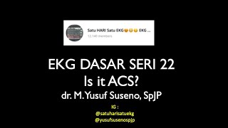 DISKUSI EKG DASAR ke 22. Is It ACS?