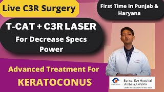 New Treatment for Keratoconus | T-CAT plus C3R Laser | Advanced Treatment | LIVE Surgery