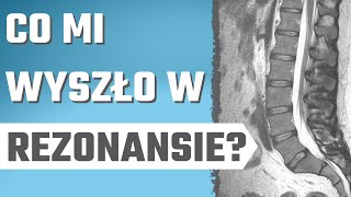 Co jest w opisie REZONANSU? - wyjaśniam - przepuklina,, dyskopatia, wypuklina, kręgozmyk