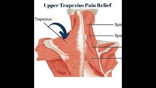 Upper Trap Trigger Point Release