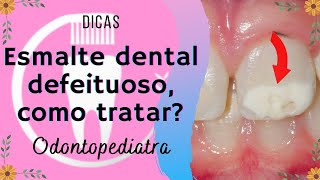 Esmalte dental defeituoso, como tratar?