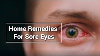 Home Remedies For SORE EYES TREATMENT | Best treatment of Sore Eyes Naturally |