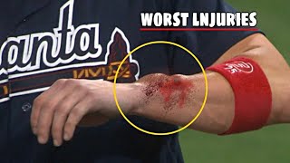 MLB- Worst Injuries• VD4