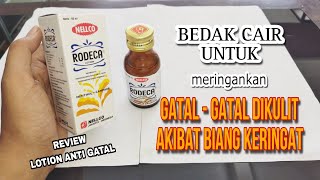 Meredakan Rasa Gatal-Gatal dikulit Akibat Biang Keringat | Rodeca Lotion Anti Gatal