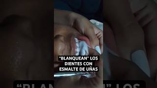 “BLANQUEAN” los dientes con ESMALTE de UÑAS