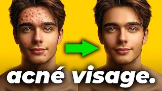 ❌ BOUTONS D’ACNÉ VISAGE : Comment en Finir Définitivement ✅