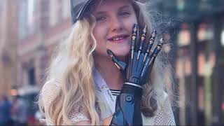 Prosthetic Arm.... How this startup is working to make kids feel proud of their prostheses