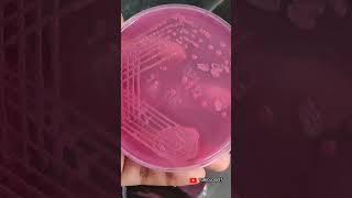 Macconkey agar | culture media | tjbiologist | biology | science | media streaking | medical