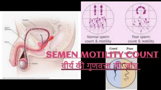 Semen analysis test I sperm count I male infertility