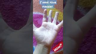 I have four fingers. #viral