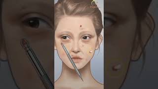 Face red acne clean face redness #youtubeshort #shortvideo